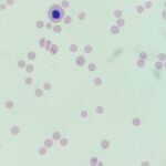 BABESIA