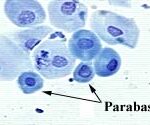 Parabasal Cells