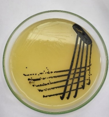 ANTIBIOTIC RESISTANCE AND PHYLOGENETIC PROFILING OF METHICILLIN ...